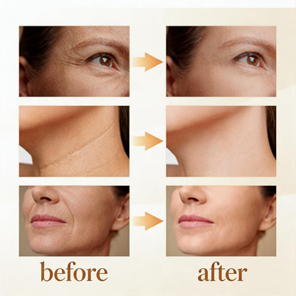 Néluve Neck Lifting Device